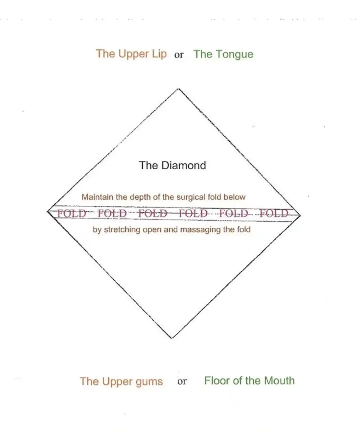 Tongue and lip tie stretch - the diamond stretch