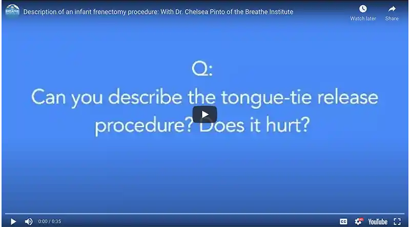 Can you Describe the Tongue-Tie Release Procedure? Does it Hurt?