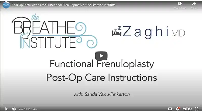 Functional Frenuloplasty post-op care instructions
